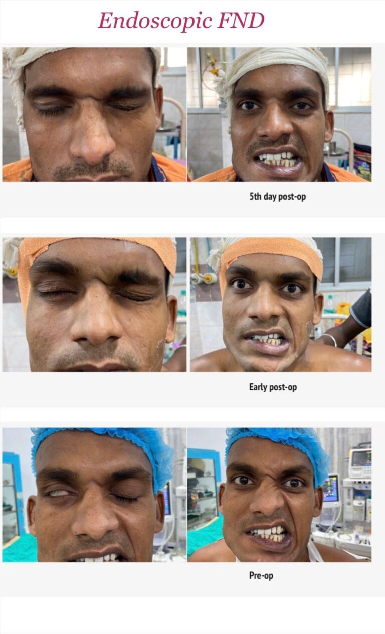 Facial Defect 1