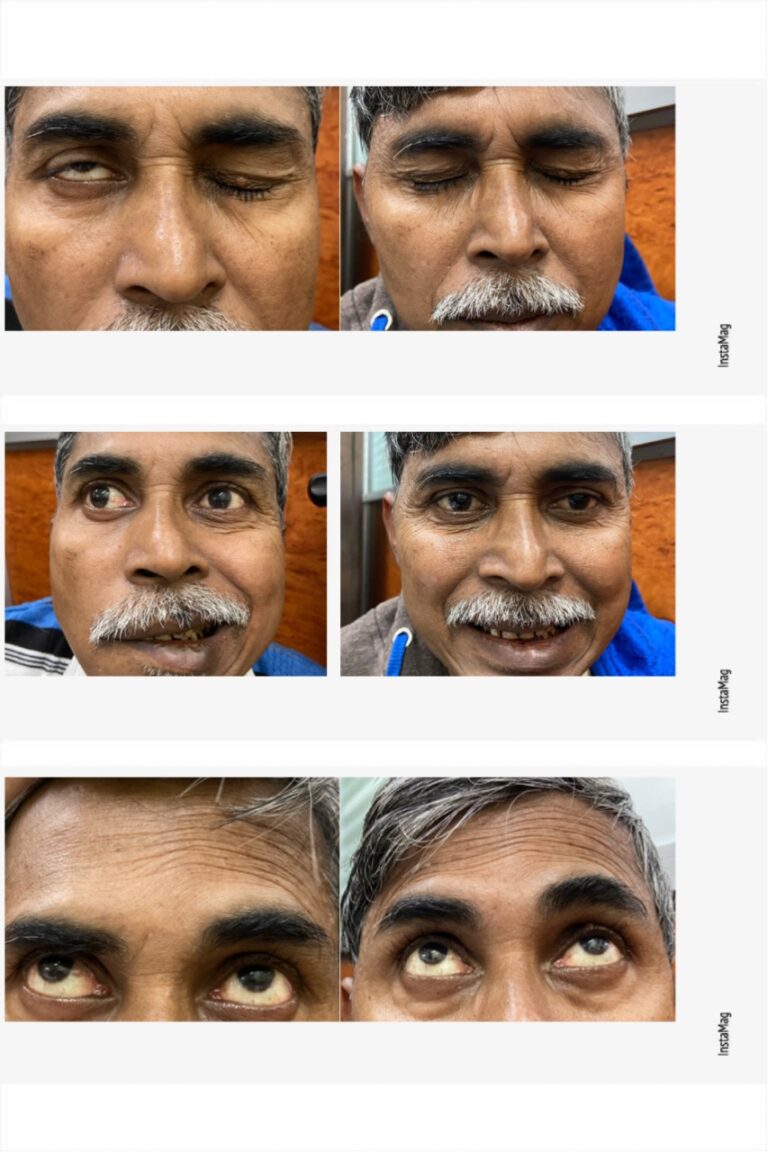 Facial Defect 2